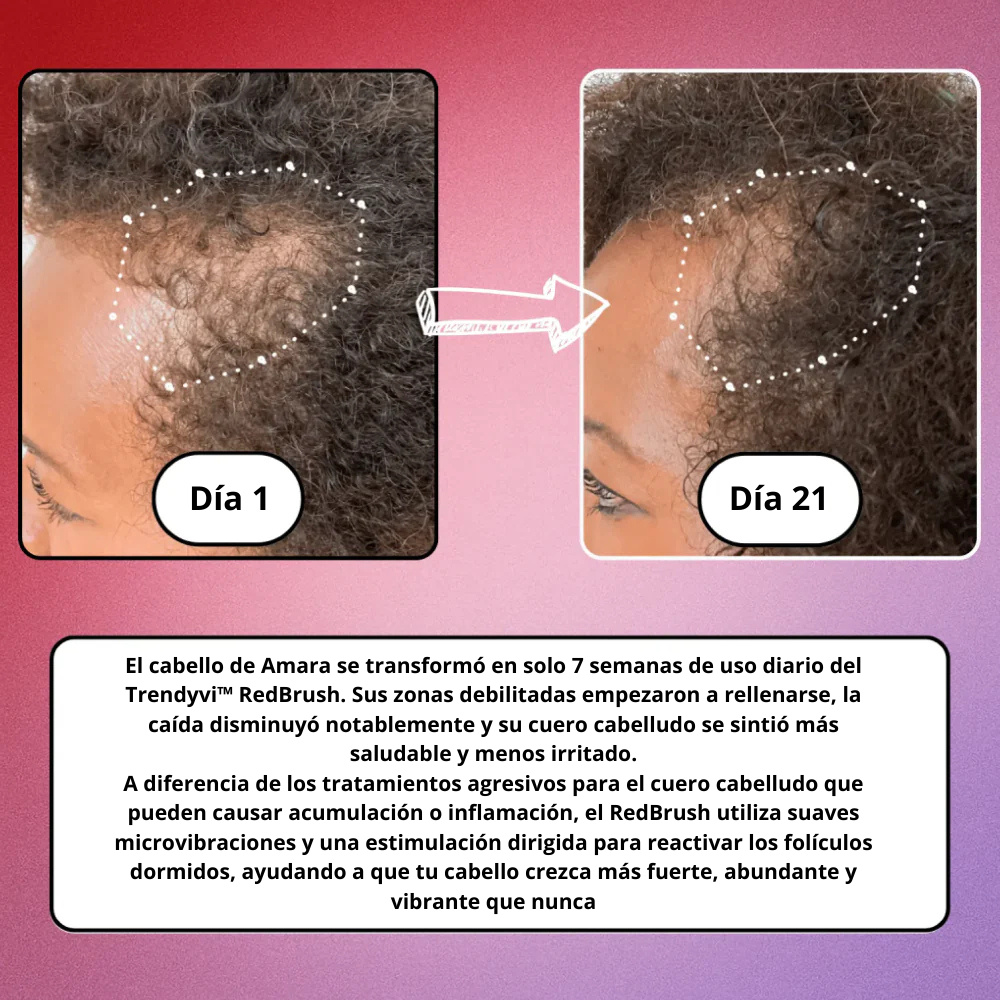 Trendyvi™ RedBrush – Tratamiento y regeneración capilar con luz roja