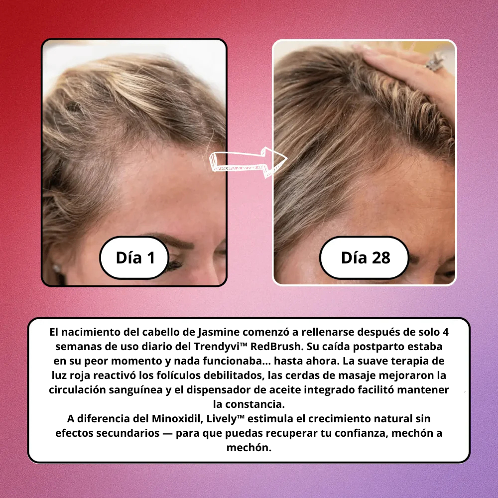 Trendyvi™ RedBrush – Tratamiento y regeneración capilar con luz roja